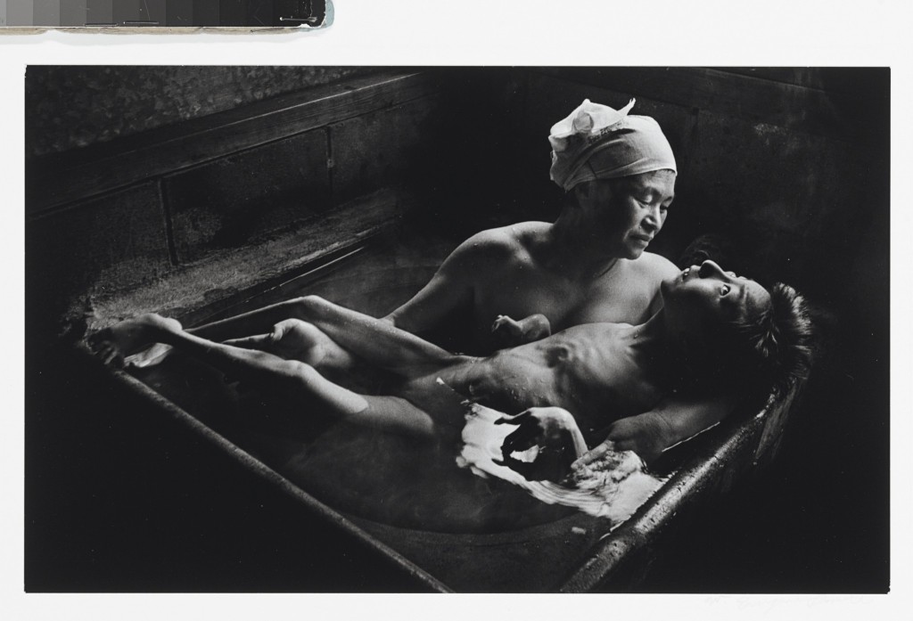 Tomoko Uemura in her bath, Minamata, Japan, 1972